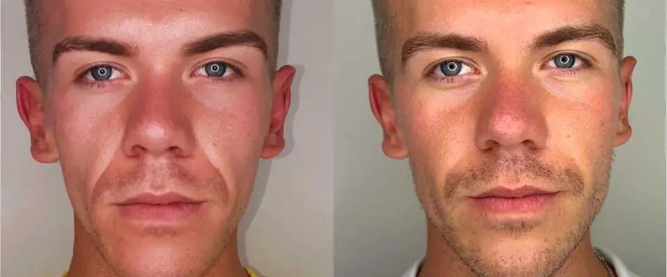 By Design Academy treatment model