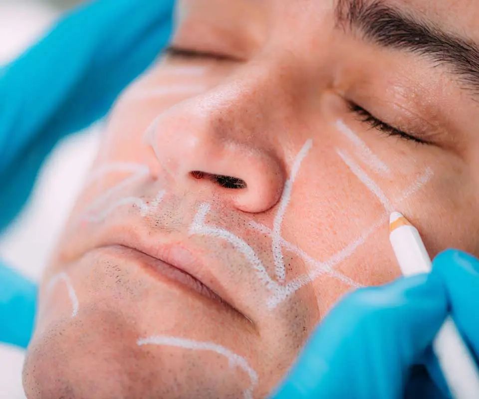Fundamental Dermal Filler Course training