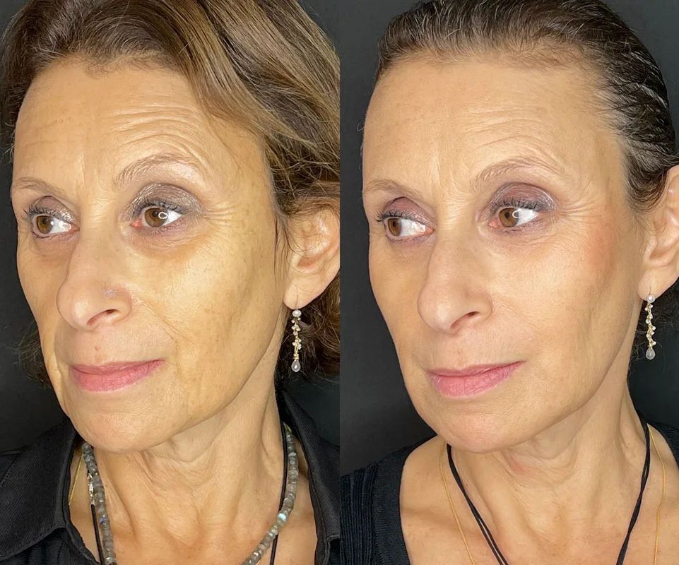 Full Face Transformation Masterclass training