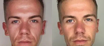 Becoming a By Design Academy filler model
